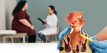Консультація проктолога – турбота про здоров’я без сором’язливості та страху