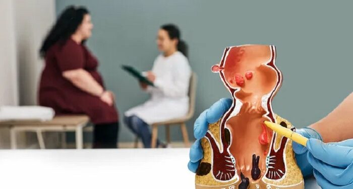 Консультація проктолога – турбота про здоров’я без сором’язливості та страху